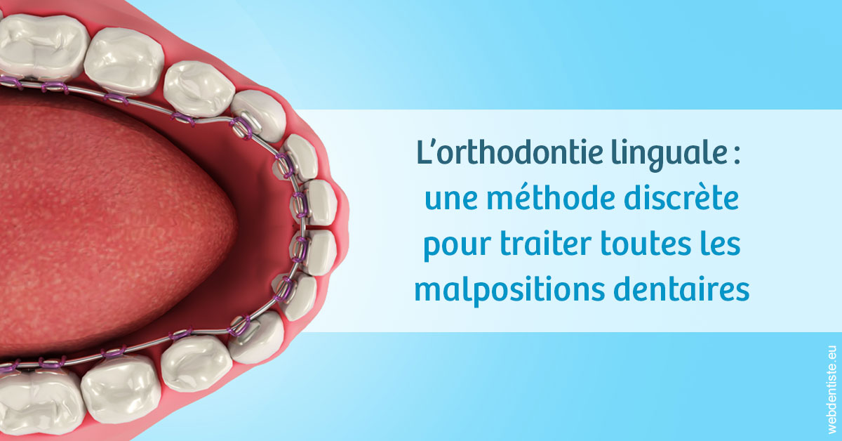 https://selarl-druet-philippe.chirurgiens-dentistes.fr/L'orthodontie linguale 1
