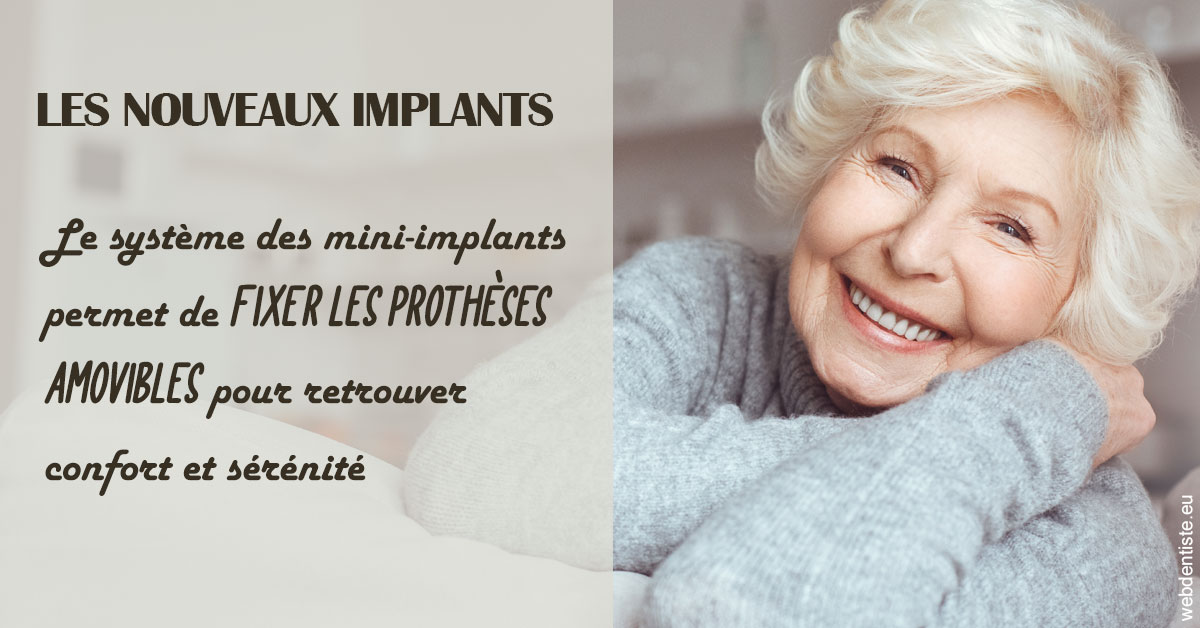 https://selarl-druet-philippe.chirurgiens-dentistes.fr/Les nouveaux implants 1