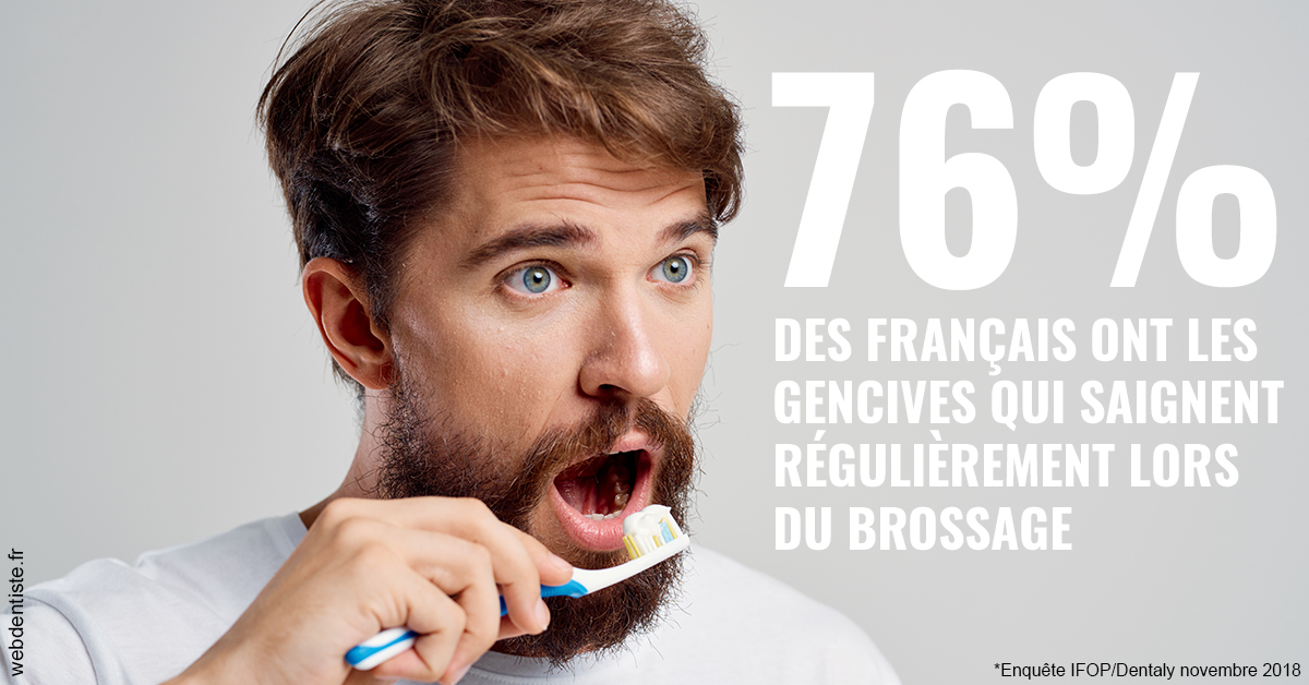 https://selarl-druet-philippe.chirurgiens-dentistes.fr/76% des Français 2