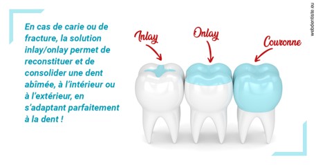 https://selarl-druet-philippe.chirurgiens-dentistes.fr/L'INLAY ou l'ONLAY