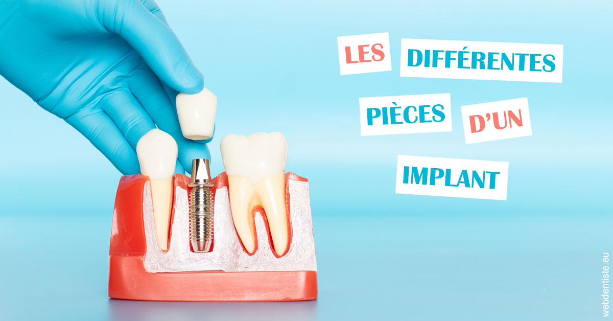 https://selarl-druet-philippe.chirurgiens-dentistes.fr/Les différentes pièces d’un implant 2