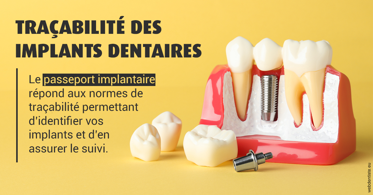 https://selarl-druet-philippe.chirurgiens-dentistes.fr/T2 2023 - Traçabilité des implants 2