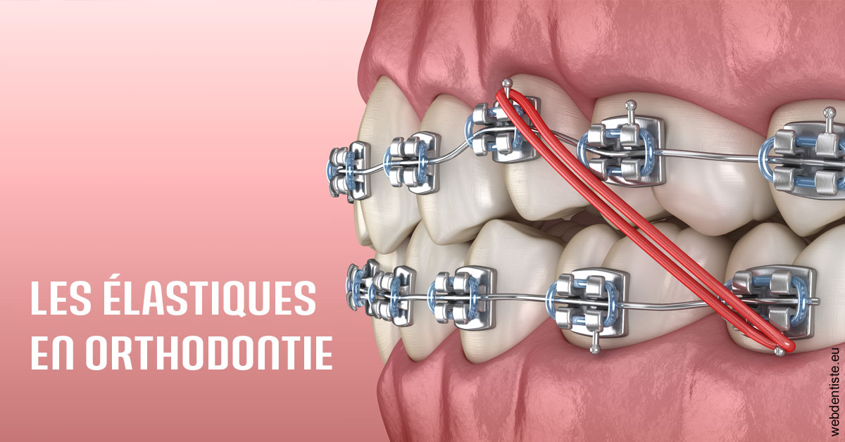 https://selarl-druet-philippe.chirurgiens-dentistes.fr/Elastiques orthodontie 2