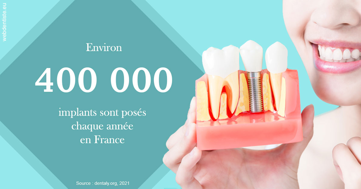 https://selarl-druet-philippe.chirurgiens-dentistes.fr/Pose d'implants en France 2