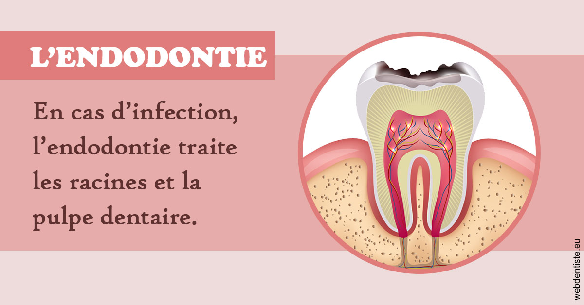 https://selarl-druet-philippe.chirurgiens-dentistes.fr/L'endodontie 2